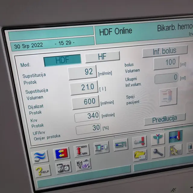 Dialysis treatment parameters on the machine screen